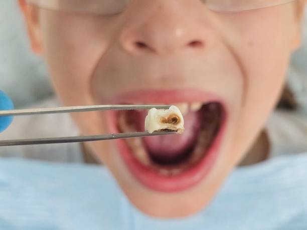 Best Weekend Emergency Dentist in Royal Pines, NC