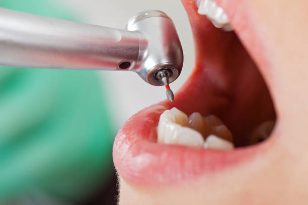 Best Holiday Emergency Dentist in Royal Pines, NC
